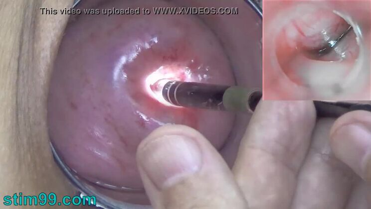 Japanese Endoscope Camera inside Cervix Cam into Pussy Uterus
