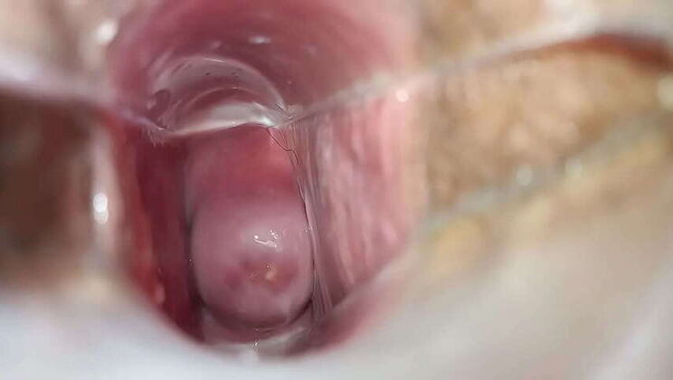 Speculum Inside Vagina: Real Orgasm